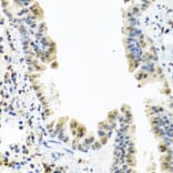 Immunohistochemistry - Anti-CALCB Antibody (A8105) - Antibodies.com