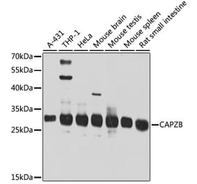 Western Blot - Anti-CAPZB Antibody (A16072) - Antibodies.com