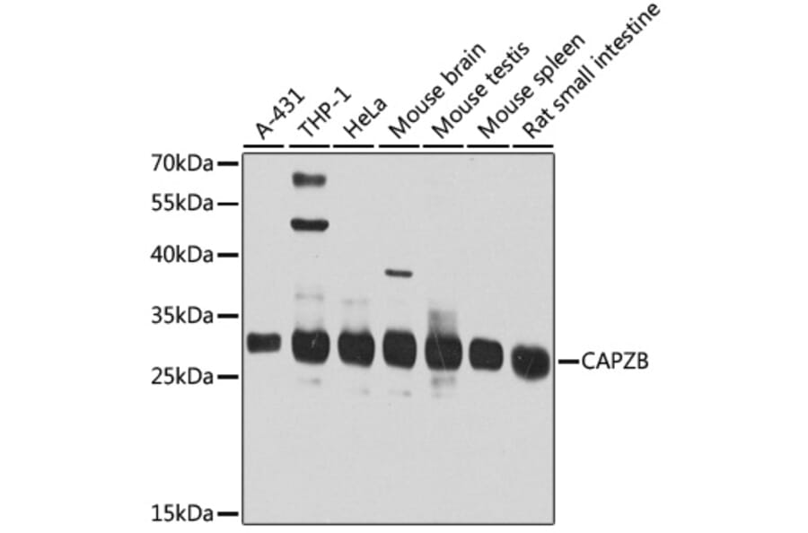 Western Blot - Anti-CAPZB Antibody (A16072) - Antibodies.com