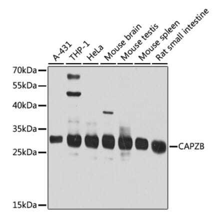 Western Blot - Anti-CAPZB Antibody (A16072) - Antibodies.com