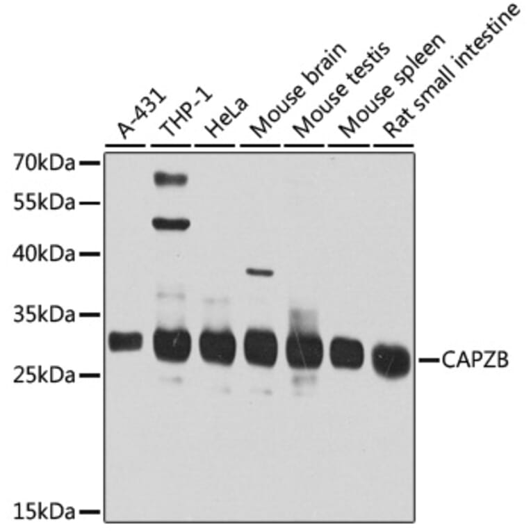 Western Blot - Anti-CAPZB Antibody (A16072) - Antibodies.com