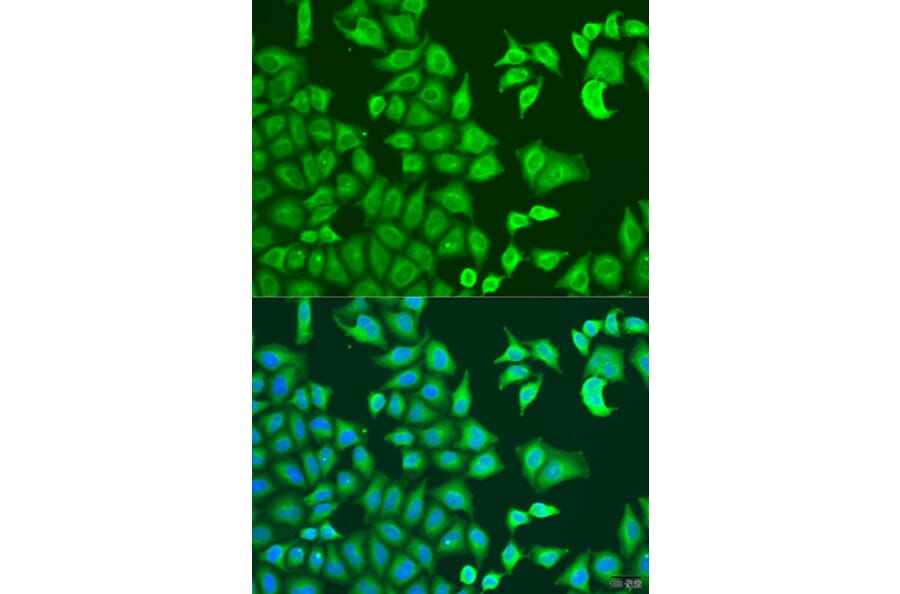 Immunofluorescence - Anti-CAPZB Antibody (A16072) - Antibodies.com
