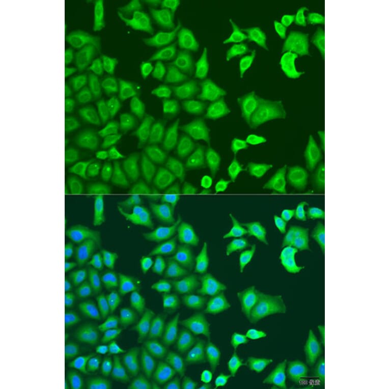 Immunofluorescence - Anti-CAPZB Antibody (A16072) - Antibodies.com