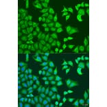 Immunofluorescence - Anti-CAPZB Antibody (A16072) - Antibodies.com