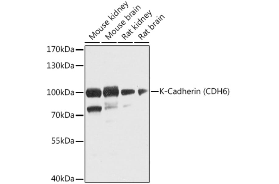 Western Blot - Anti-K Cadherin/CDH6 Antibody (A16073) - Antibodies.com