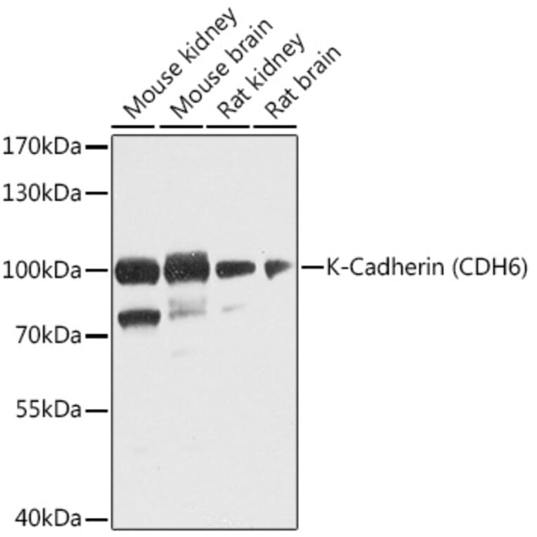 Western Blot - Anti-K Cadherin/CDH6 Antibody (A16073) - Antibodies.com