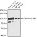 Western Blot - Anti-K Cadherin/CDH6 Antibody (A16073) - Antibodies.com