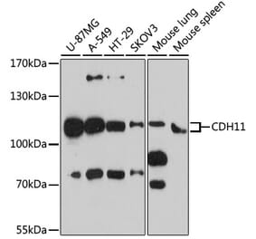 Western Blot - Anti-OB Cadherin Antibody (A16074) - Antibodies.com