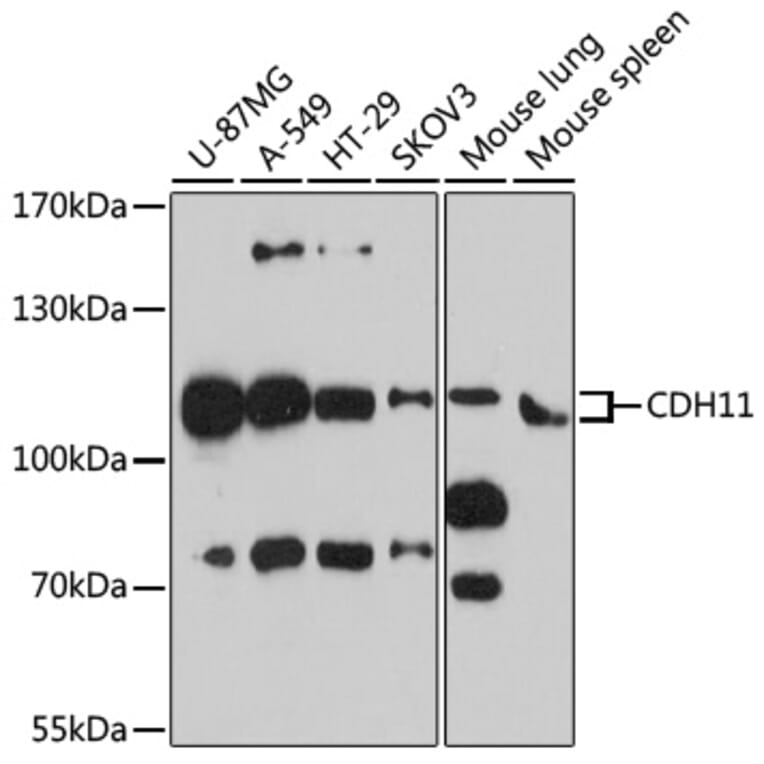 Western Blot - Anti-OB Cadherin Antibody (A16074) - Antibodies.com