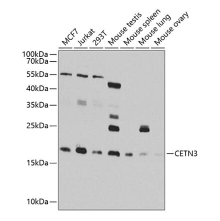 Western Blot - Anti-Centrin 3 Antibody (A16075) - Antibodies.com