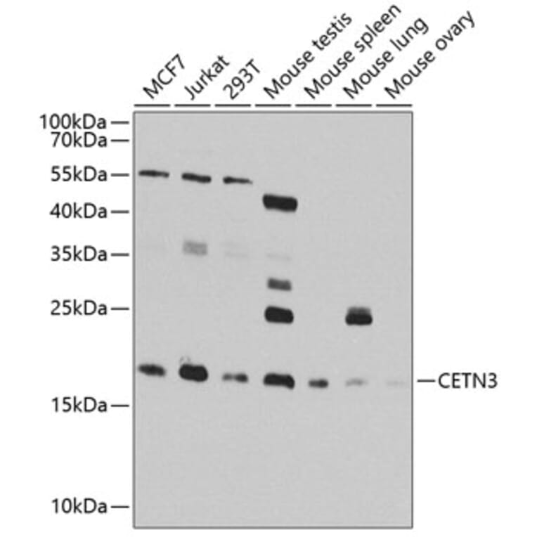 Western Blot - Anti-Centrin 3 Antibody (A16075) - Antibodies.com