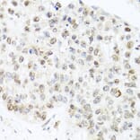 Immunohistochemistry - Anti-Centrin 3 Antibody (A16075) - Antibodies.com
