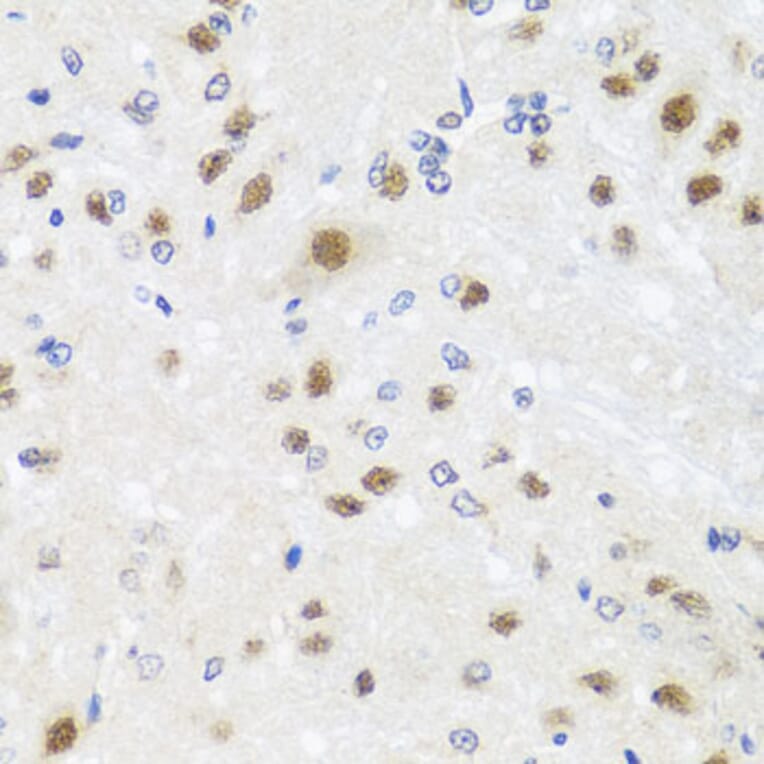 Immunohistochemistry - Anti-Centrin 3 Antibody (A16075) - Antibodies.com