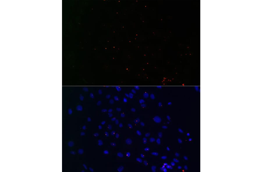 Immunofluorescence - Anti-Centrin 3 Antibody (A16075) - Antibodies.com