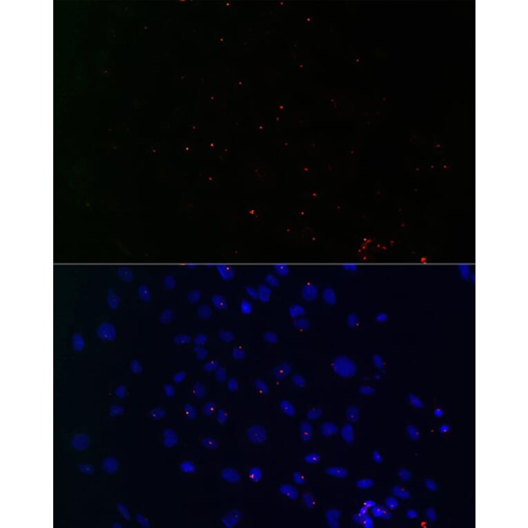 Immunofluorescence - Anti-Centrin 3 Antibody (A16075) - Antibodies.com