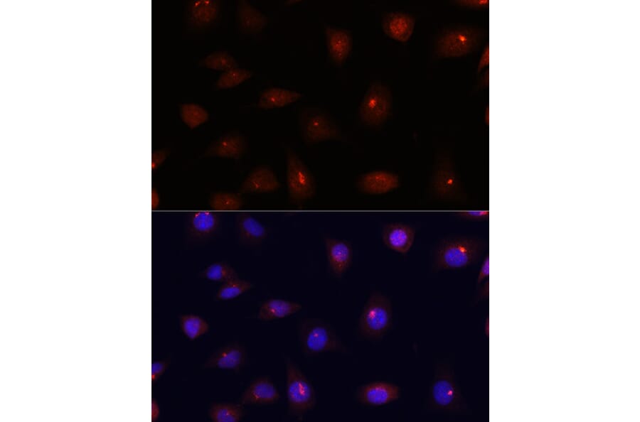 Immunofluorescence - Anti-Centrin 3 Antibody (A16075) - Antibodies.com