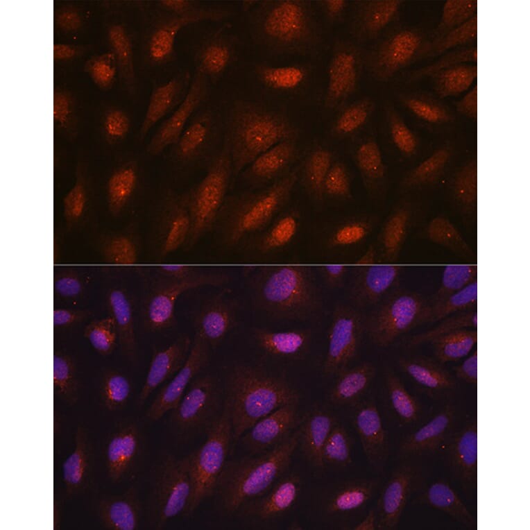 Immunofluorescence - Anti-Centrin 3 Antibody (A16075) - Antibodies.com