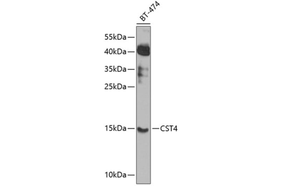 Western Blot - Anti-Cystatin S Antibody (A16076) - Antibodies.com