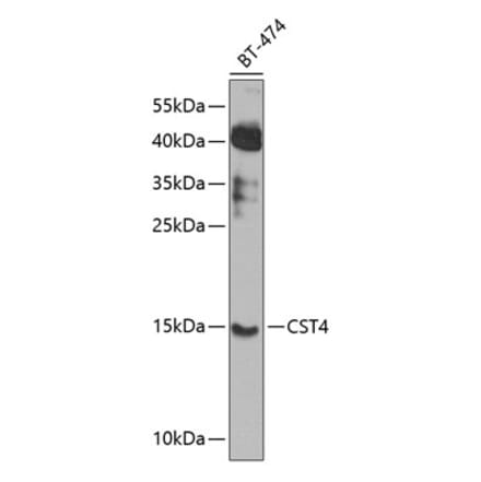 Western Blot - Anti-Cystatin S Antibody (A16076) - Antibodies.com