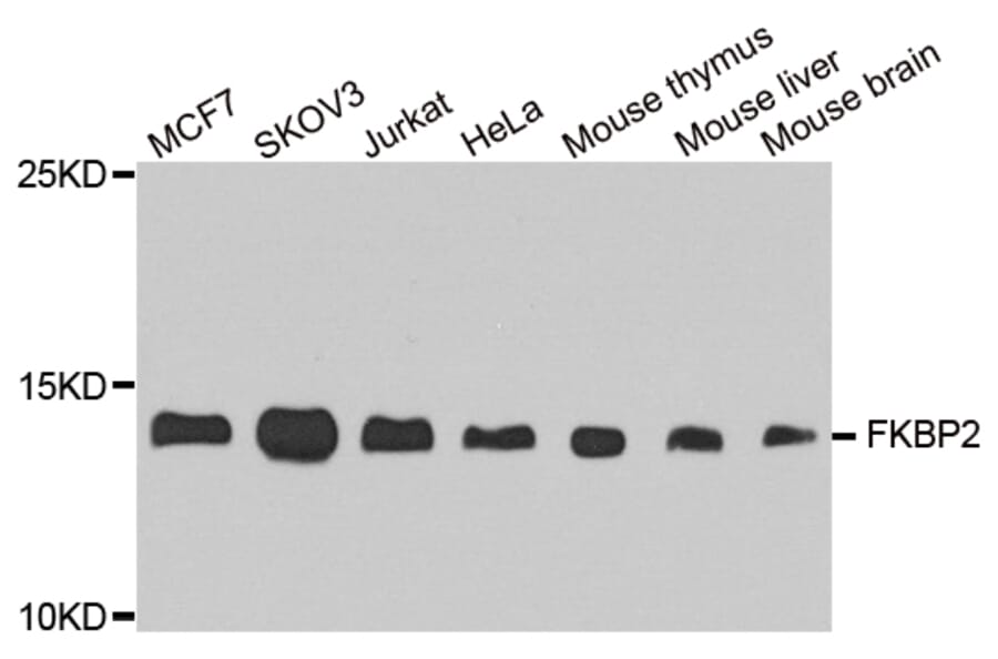Western Blot - Anti-FKBP2 Antibody (A8120) - Antibodies.com