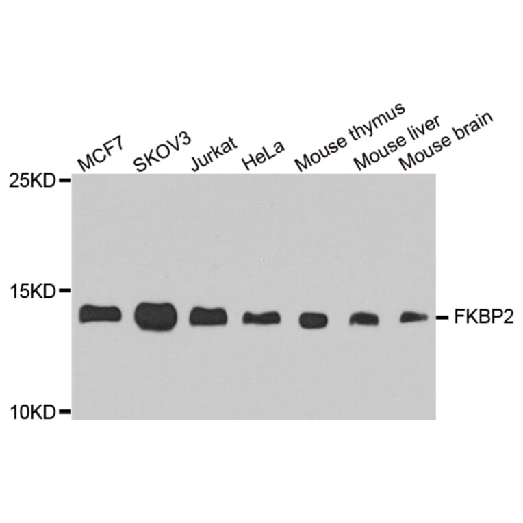 Western Blot - Anti-FKBP2 Antibody (A8120) - Antibodies.com