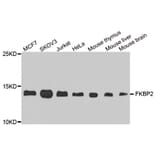 Western Blot - Anti-FKBP2 Antibody (A8120) - Antibodies.com