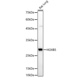 Western Blot - Anti-HOXB5 Antibody (A16080) - Antibodies.com