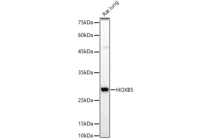 Western Blot - Anti-HOXB5 Antibody (A16080) - Antibodies.com