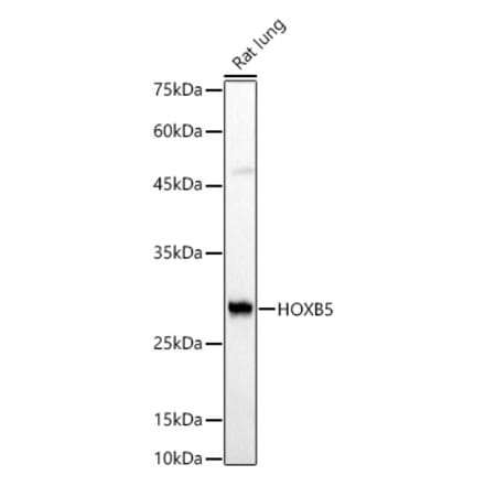 Western Blot - Anti-HOXB5 Antibody (A16080) - Antibodies.com