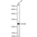 Western Blot - Anti-HOXB5 Antibody (A16080) - Antibodies.com