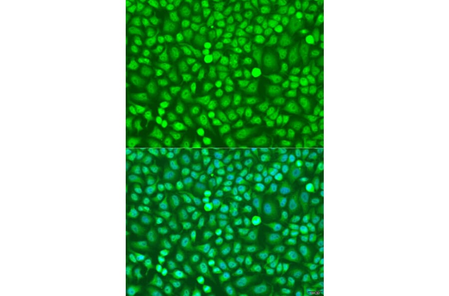 Immunofluorescence - Anti-HOXB5 Antibody (A16080) - Antibodies.com