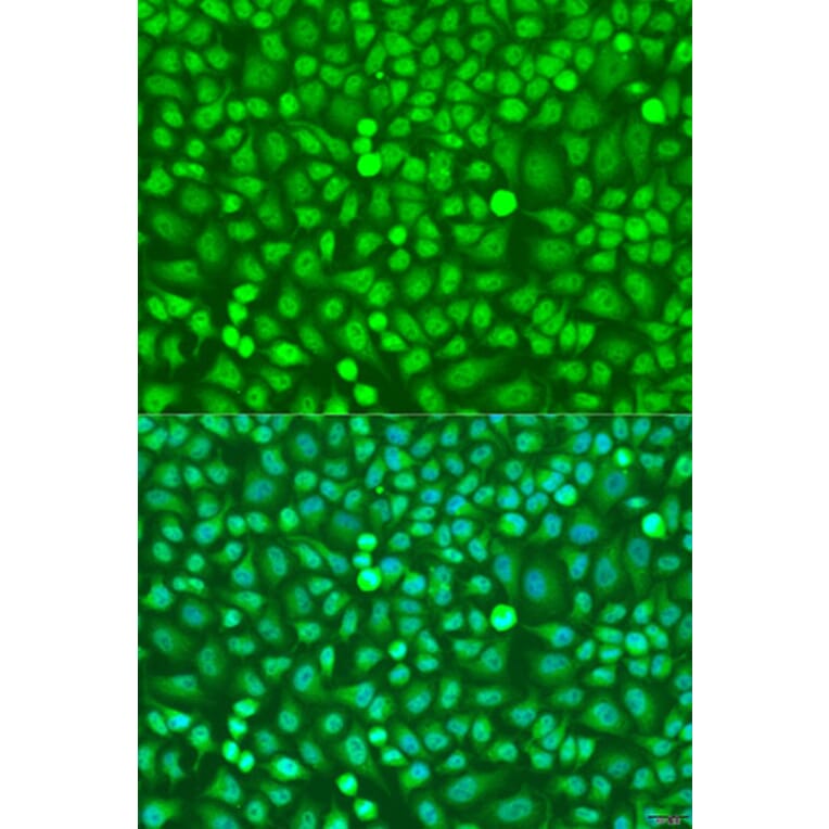 Immunofluorescence - Anti-HOXB5 Antibody (A16080) - Antibodies.com