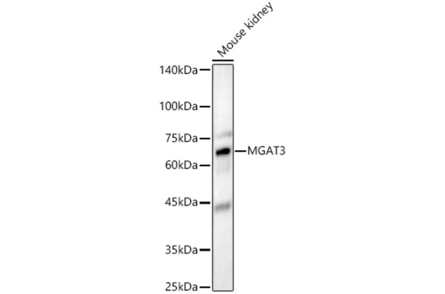 Western Blot - Anti-MGAT3 Antibody (A16082) - Antibodies.com