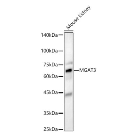 Western Blot - Anti-MGAT3 Antibody (A16082) - Antibodies.com