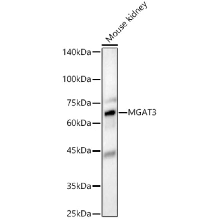 Western Blot - Anti-MGAT3 Antibody (A16082) - Antibodies.com