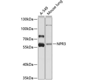 Western Blot - Anti-NPR-C Antibody (A16083) - Antibodies.com