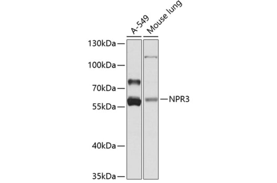 Western Blot - Anti-NPR-C Antibody (A16083) - Antibodies.com