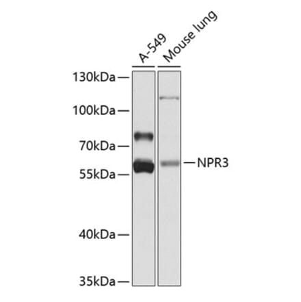 Western Blot - Anti-NPR-C Antibody (A16083) - Antibodies.com