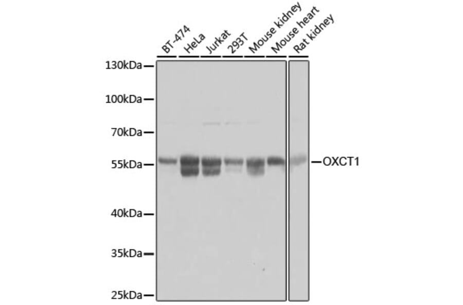 Western Blot - Anti-OXCT1/SCOT Antibody (A16084) - Antibodies.com