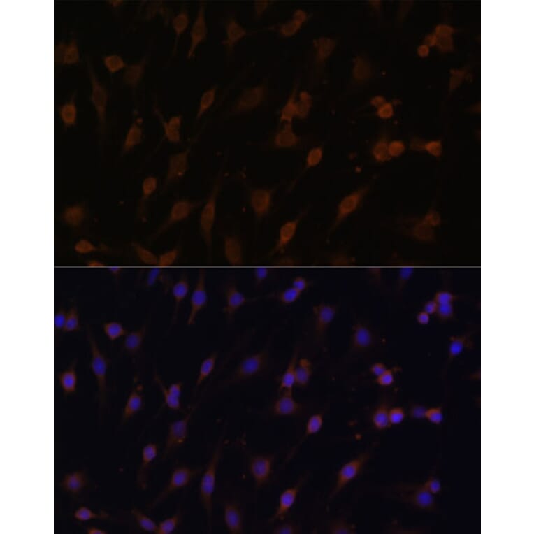 Immunofluorescence - Anti-Cytochrome P450 Reductase Antibody (A16086) - Antibodies.com