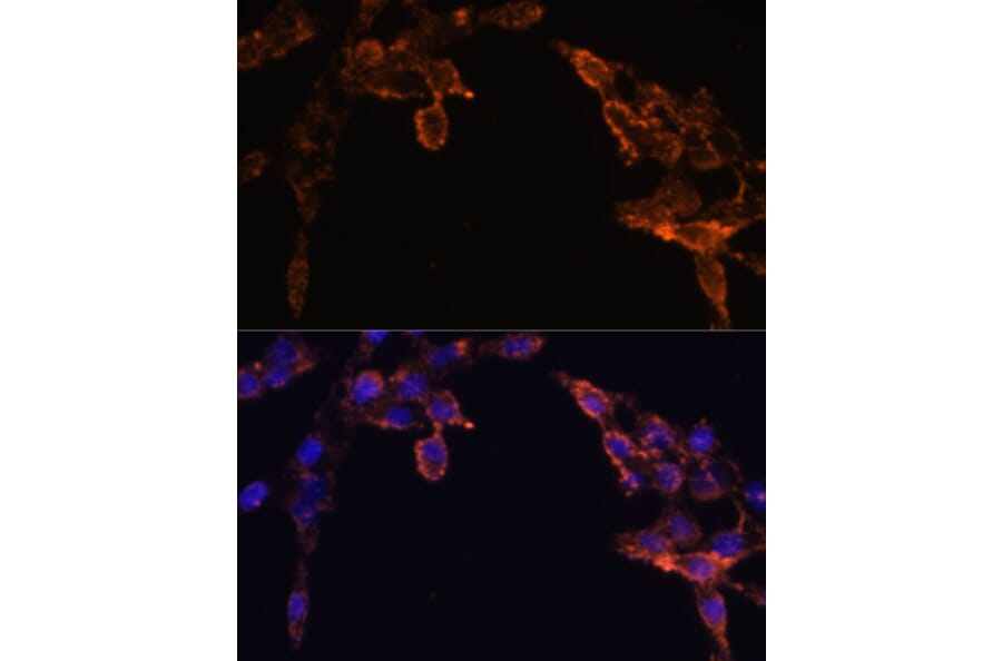 Immunofluorescence - Anti-Cytochrome P450 Reductase Antibody (A16086) - Antibodies.com