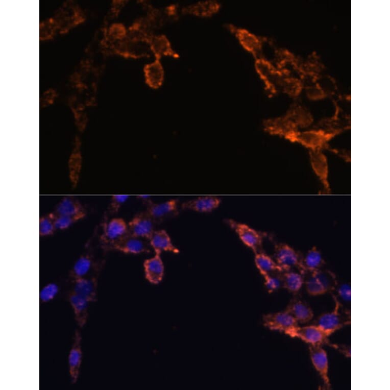 Immunofluorescence - Anti-Cytochrome P450 Reductase Antibody (A16086) - Antibodies.com