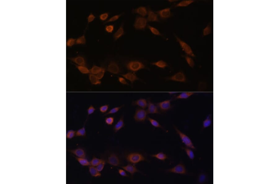 Immunofluorescence - Anti-Cytochrome P450 Reductase Antibody (A16086) - Antibodies.com