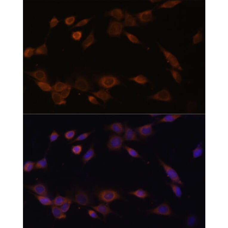 Immunofluorescence - Anti-Cytochrome P450 Reductase Antibody (A16086) - Antibodies.com