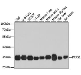 Western Blot - Anti-PRPS1 Antibody (A16088) - Antibodies.com
