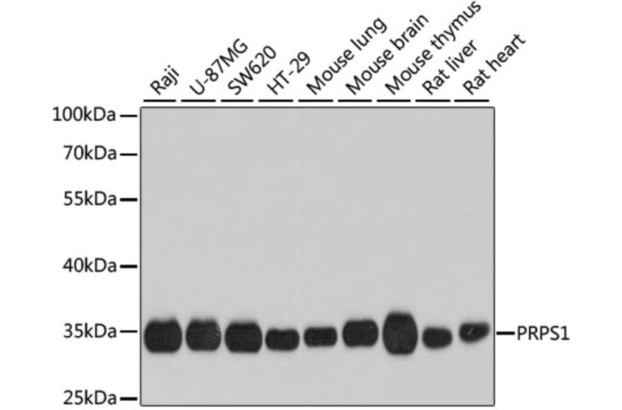 Western Blot - Anti-PRPS1 Antibody (A16088) - Antibodies.com