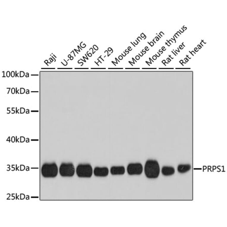 Western Blot - Anti-PRPS1 Antibody (A16088) - Antibodies.com