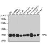 Western Blot - Anti-PRPS1 Antibody (A16088) - Antibodies.com