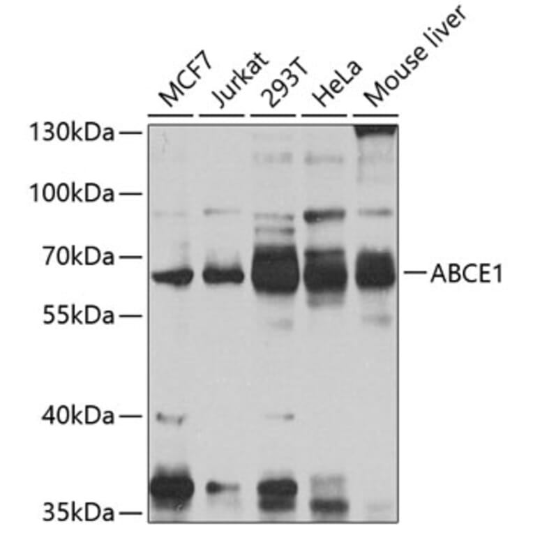 Western Blot - Anti-ABCE1 Antibody (A16089) - Antibodies.com