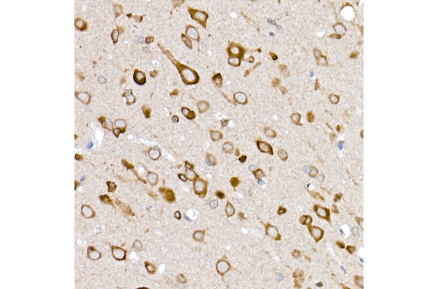 Immunohistochemistry - Anti-Glucose Transporter GLUT3 Antibody (A16090) - Antibodies.com